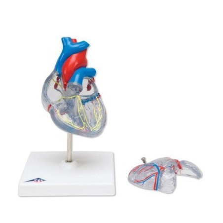Πρόπλασμα καρδιάς -Συσκευές λεμφοιδήματος - Πελματογράφος -Προπλάσματα