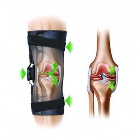 Πλαστικός μηροκνημικός νάρθηκας οστεοαρθρίτιδας γόνατος -Γόνατο-Ισχίο