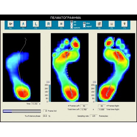 Δωρεάν πελματογράφημα και κινητική ανάλυση βάδισης -Πελματογράφημα-Πέλματα Σιλικόνης-Κρέμες ποδιών